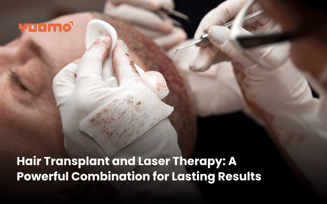 Hair Transplant and Laser Therapy: A Powerful Combination for Lasting Results