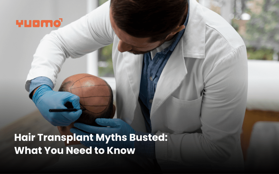 Hair Transplant Myths Busted: What You Need to Know