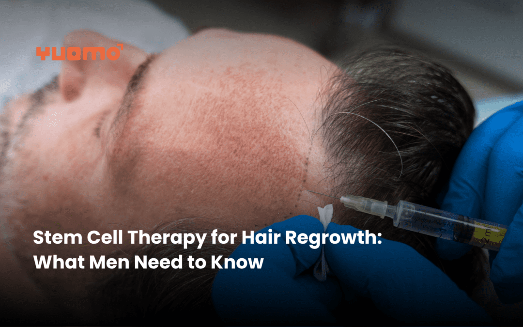 Stem Cell Therapy for Hair Regrowth: What Men Need to Know