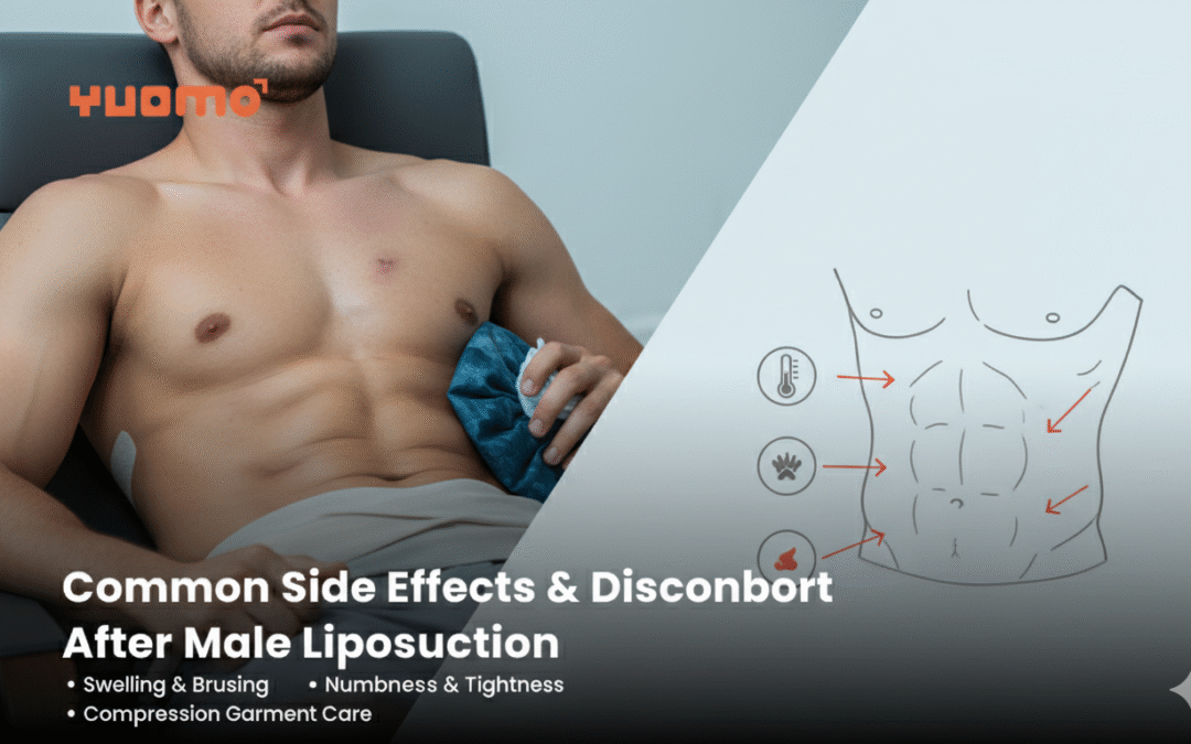 Common Side Effects & Discomfort After Male Liposuction 