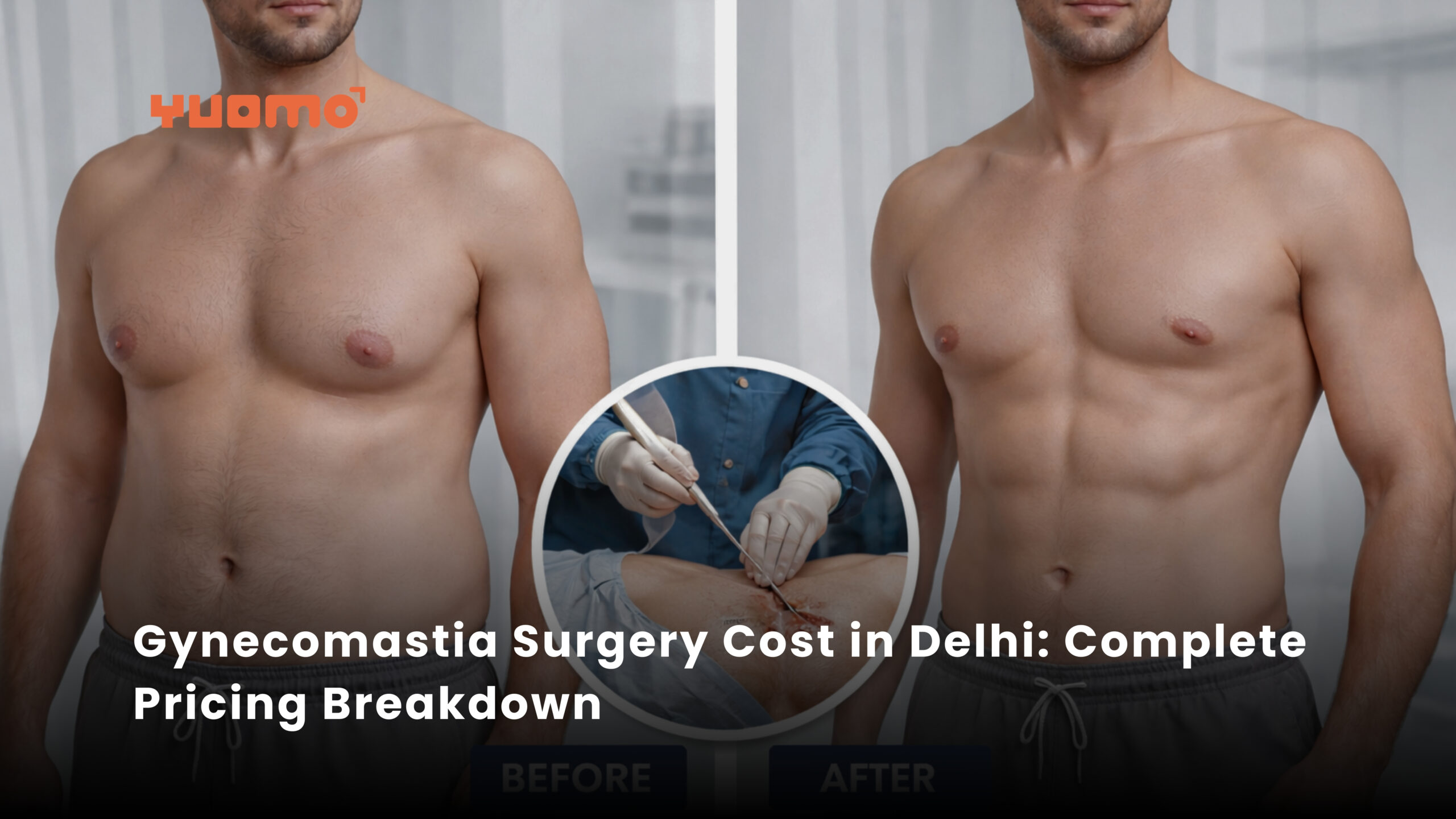 Ovarian Rejuvenation - Delhi IVF Ovarian Rejuvenation - Delhi IVF