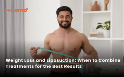 Weight Loss and Liposuction: When to Combine Treatments for the Best Results