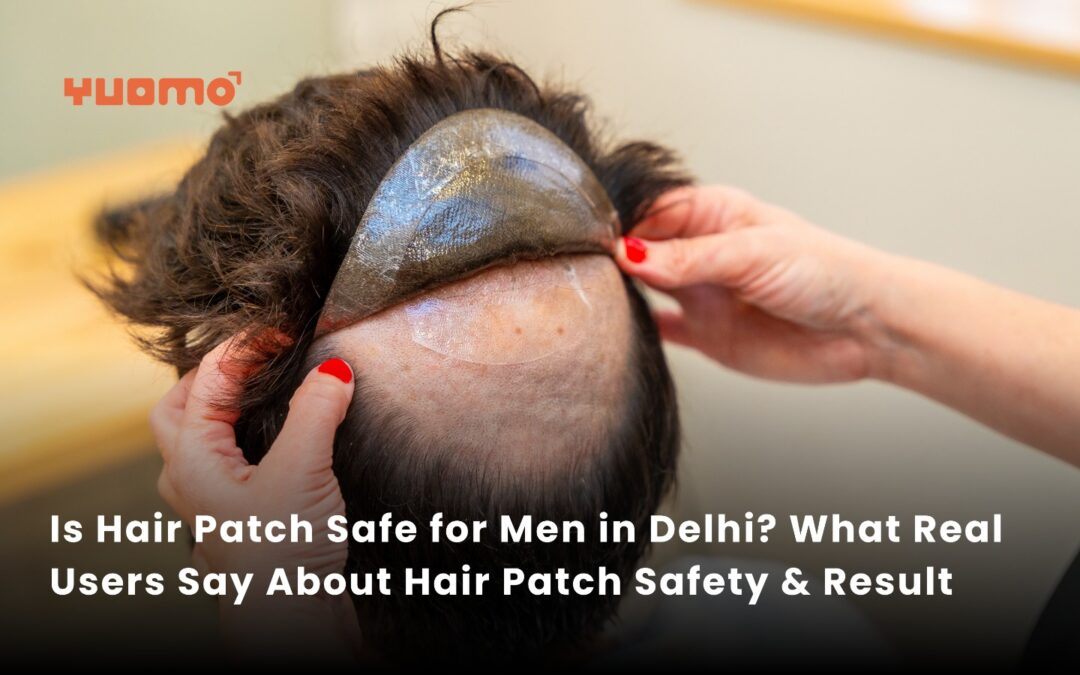 Is Hair Patch Safe for Men in Delhi? What Real Users Say About Hair Patch Safety & Results