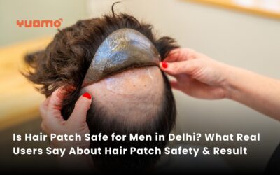 Is Hair Patch Safe for Men in Delhi? What Real Users Say About Hair Patch Safety & Results