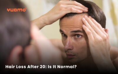 Hair Loss Before 20: Is It Normal? Why Young Men Are Losing Hair Early