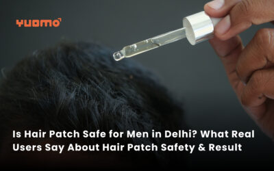 Is Hair Patch Safe for Men in Delhi? What Real Users Say About Hair Patch Safety & Results